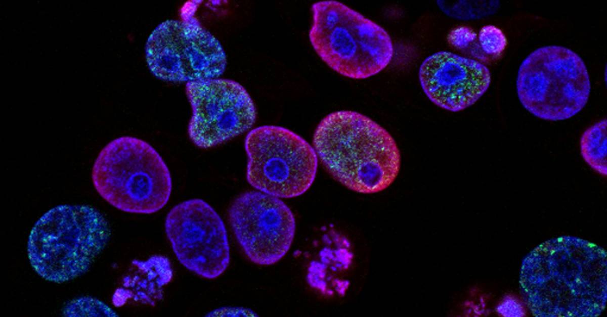 Células en cultivo observadas al microscopio de fluorescencia, en tonos morados y azules