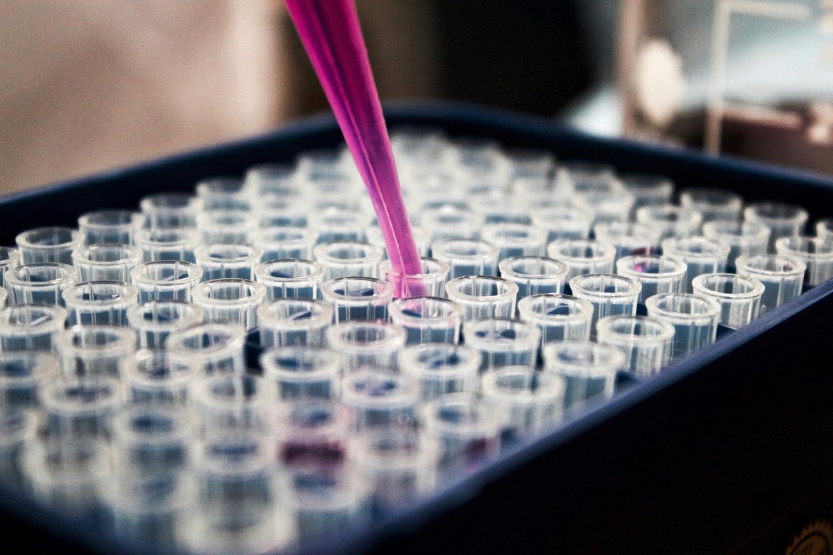 Pipeta multicanal dispensando líquido sobre una placa de pocillos de laboratorio