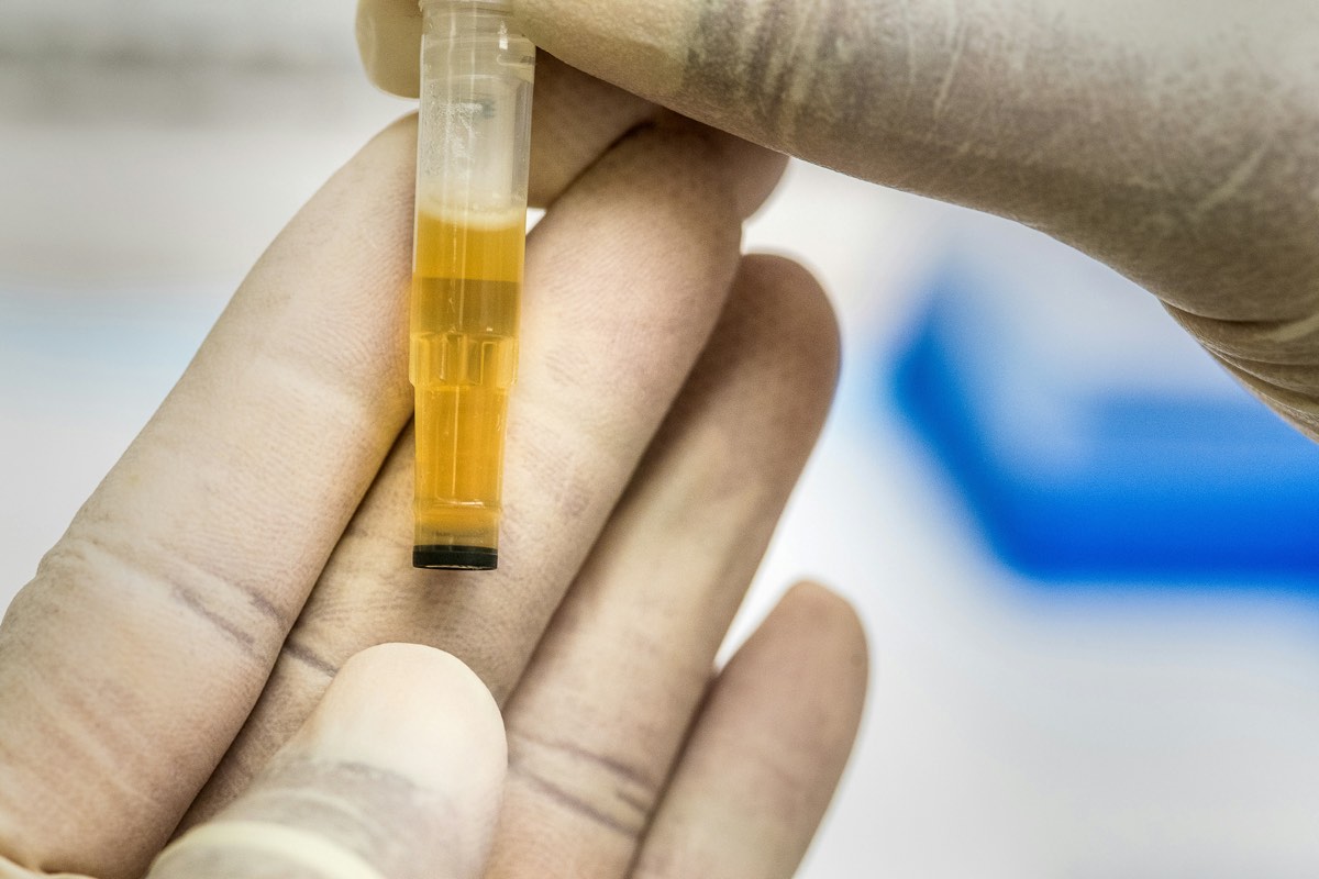 Investigador con guantes inspeccionando de cerca un vial con líquido en un laboratorio